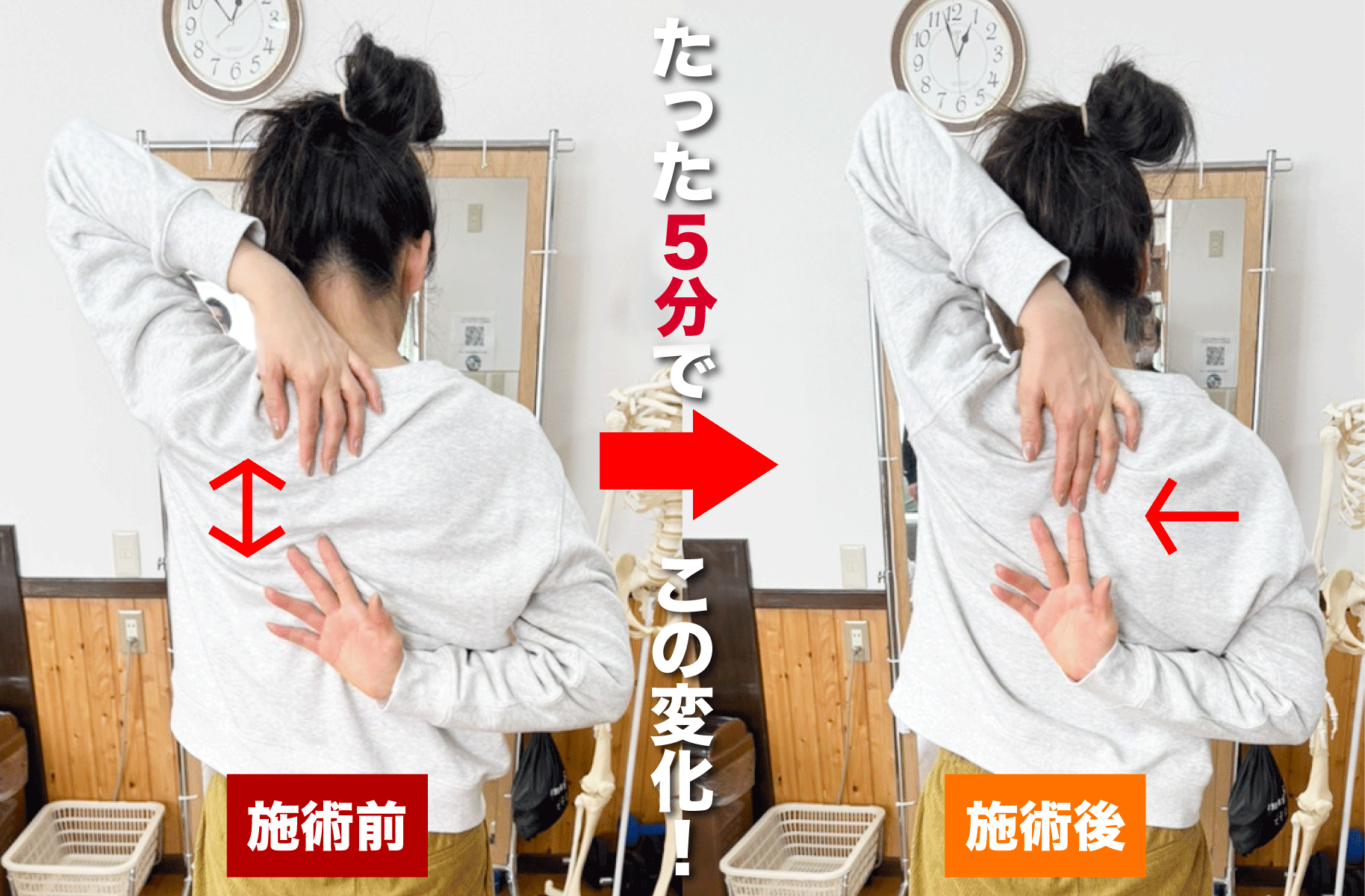 施術前後のビフォーアフター 骨盤矯正