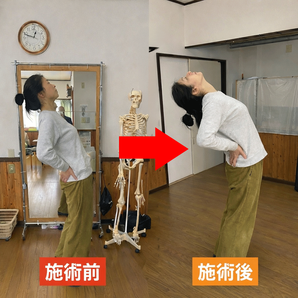 施術前後のビフォーアフター 可動域改善